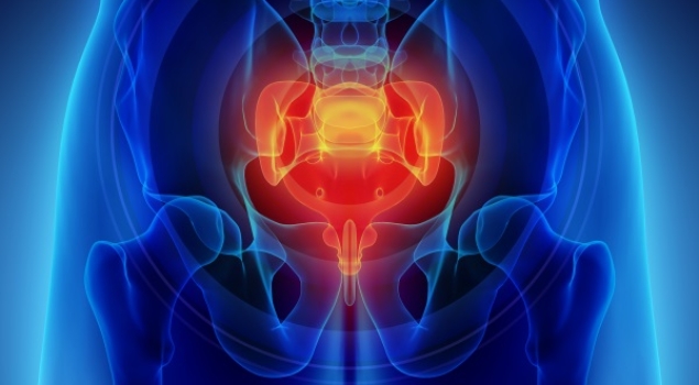 Χρόνιος πυελικός πόνος